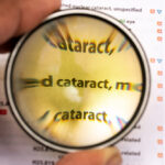Son las cataratas un problema de salud visual que no distingue edades
