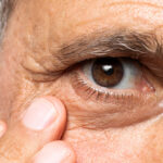 Se encuentra Glaucoma entre las principales causas de ceguera en el mundo