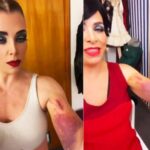 Sufre Lisset caída en coladera en Polanco: “Este bíceps me salvó la vida”